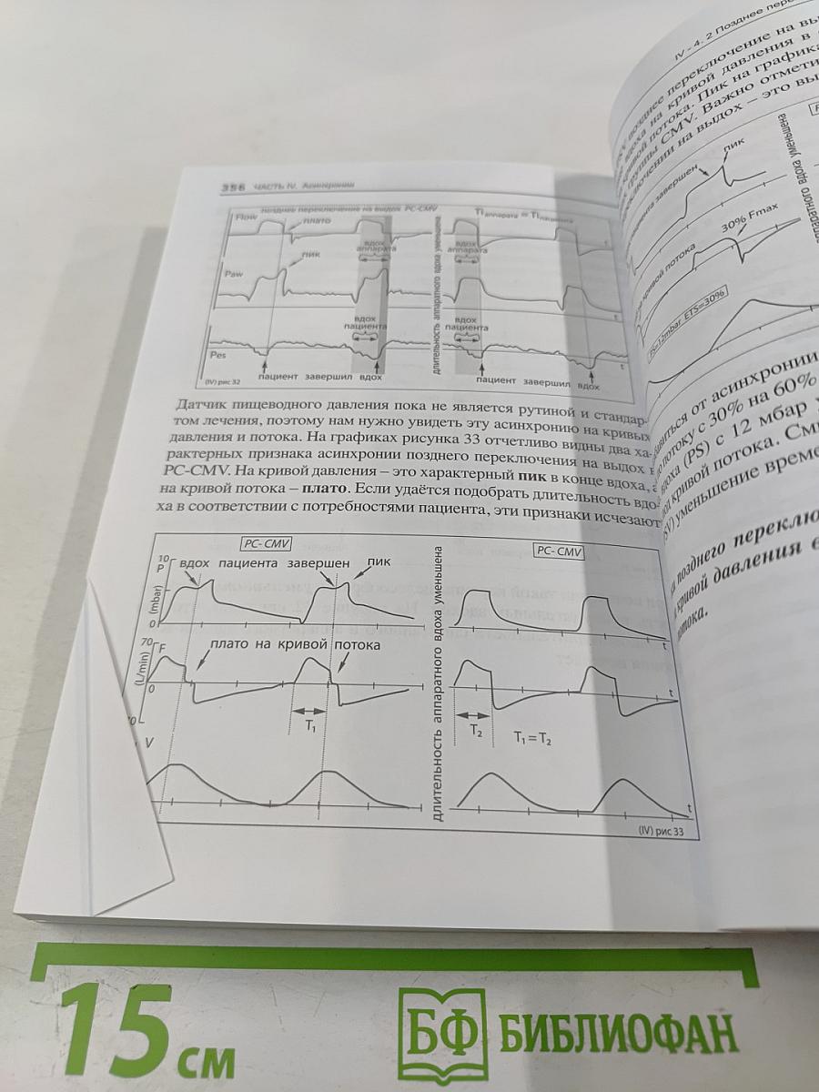 Асинхронии и графика ИВЛ. Руководство для врачей