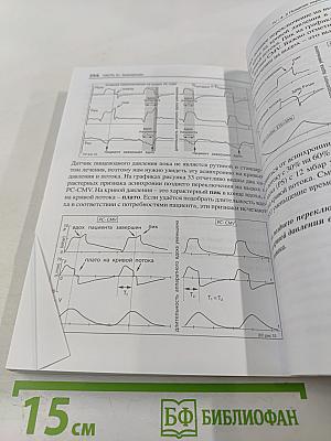 Асинхронии и графика ИВЛ. Руководство для врачей