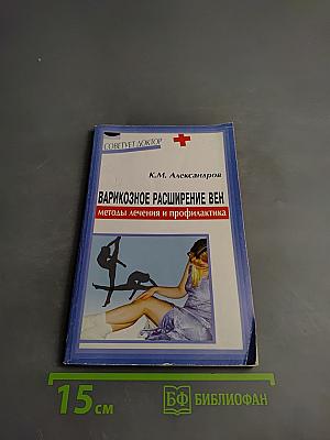 Варикозное расширение вен: методы лечения и профилактика