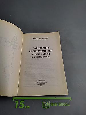 Варикозное расширение вен: методы лечения и профилактика