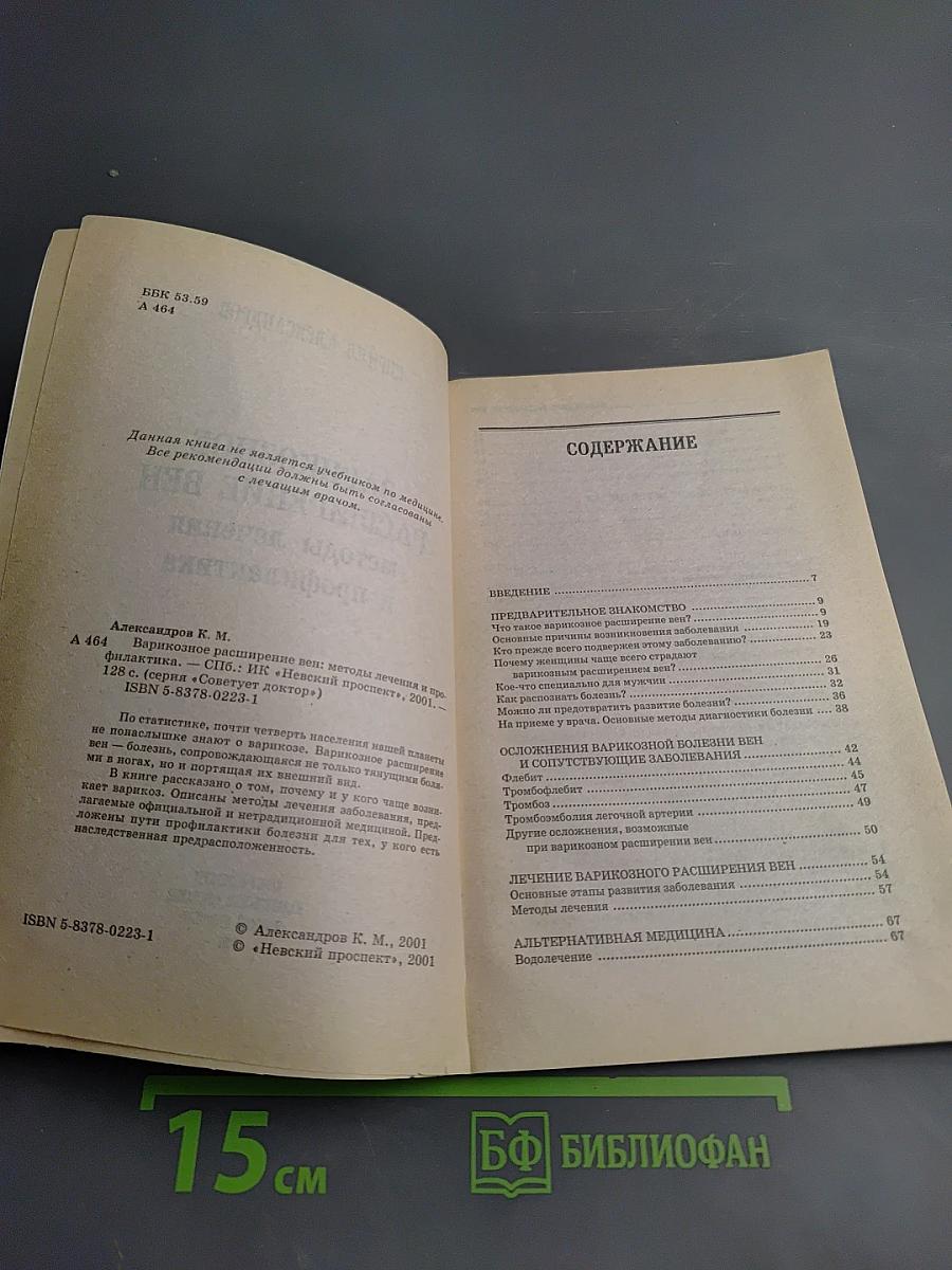 Варикозное расширение вен: методы лечения и профилактика