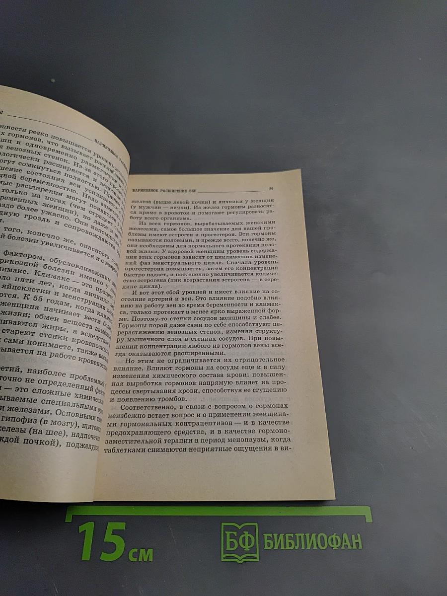 Варикозное расширение вен: методы лечения и профилактика