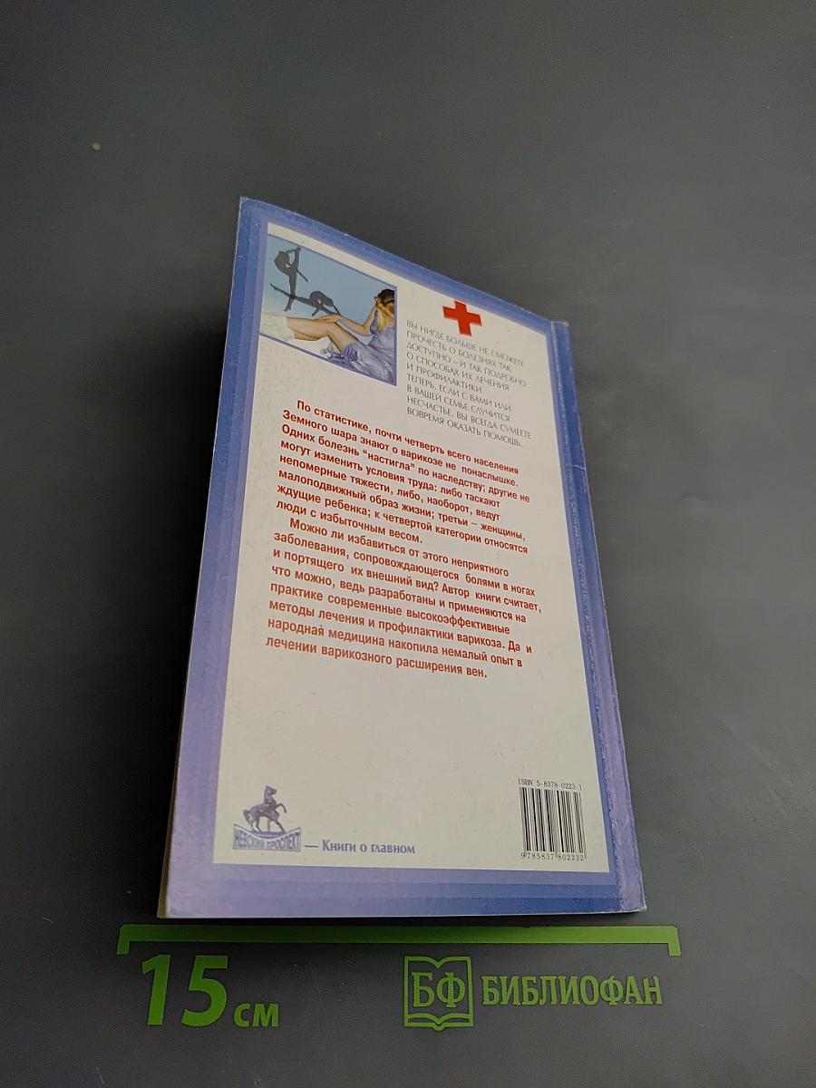 Варикозное расширение вен: методы лечения и профилактика