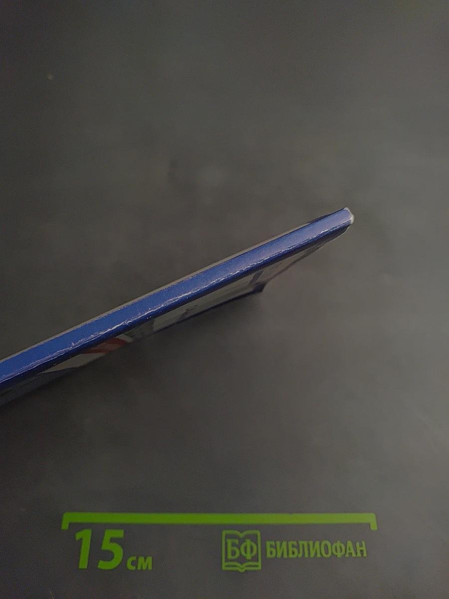 Варикозное расширение вен: методы лечения и профилактика