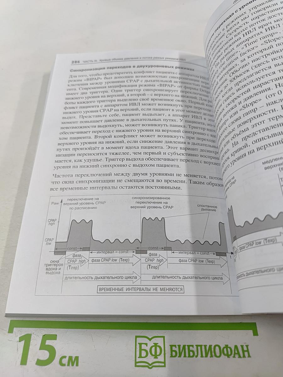 Асинхронии и графика ИВЛ