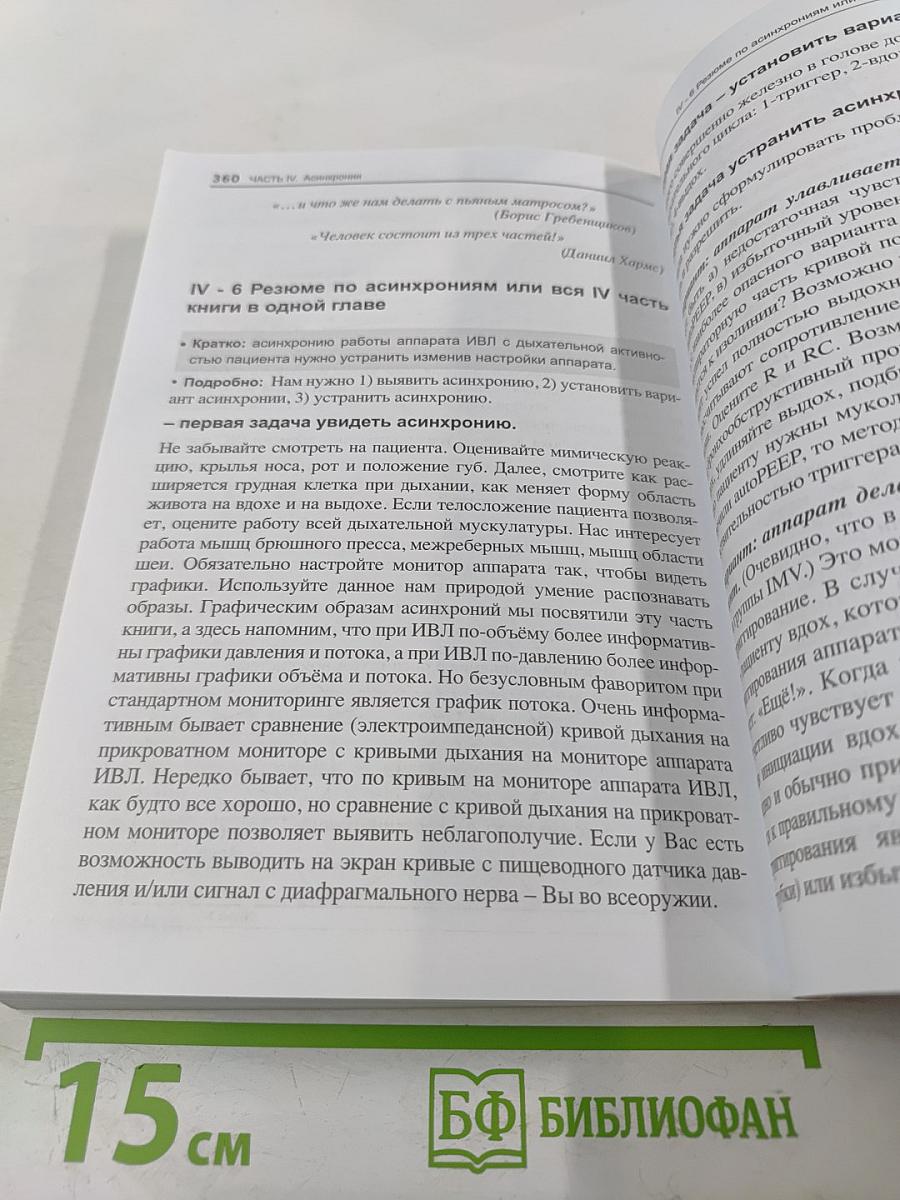 Асинхронии и графика ИВЛ