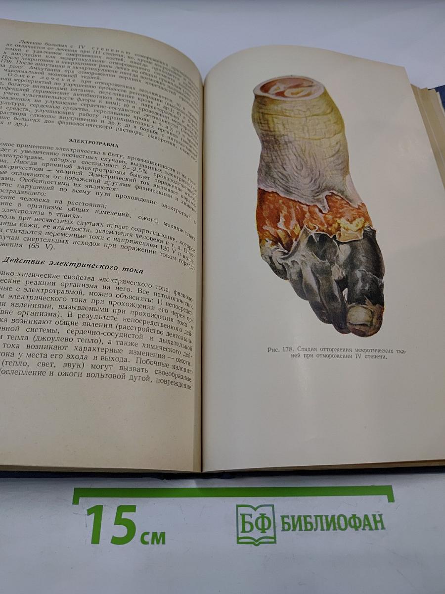 Общая хирургия