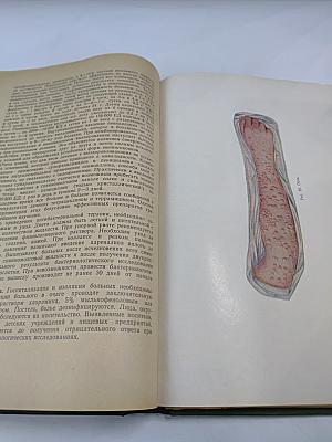 Учебник инфекционных болезней