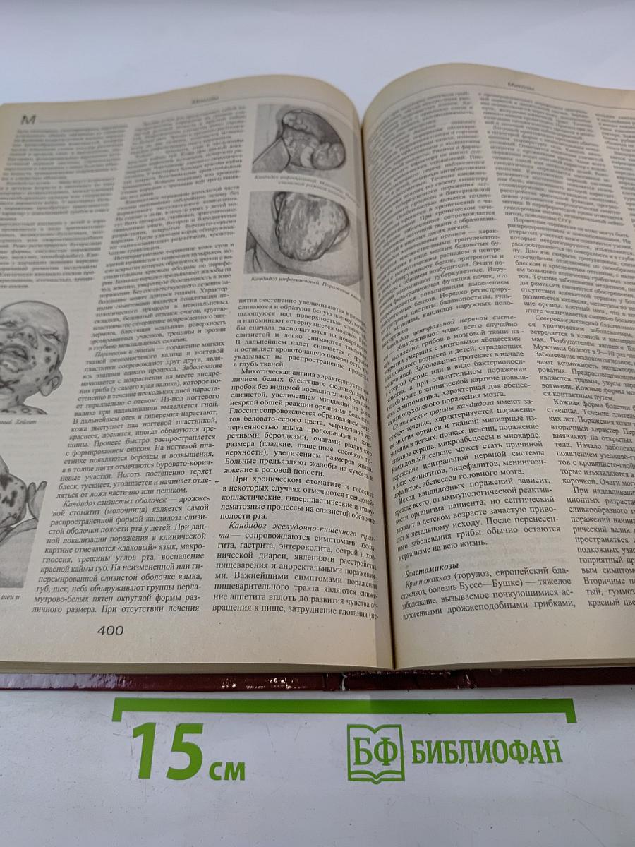 Большая медицинская энциклопедия