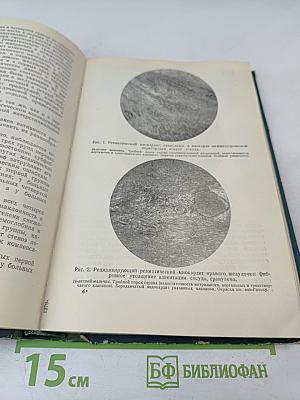 Ревматизм: Сборник научных трудов