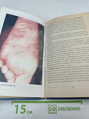 Кожные и венерические болезни