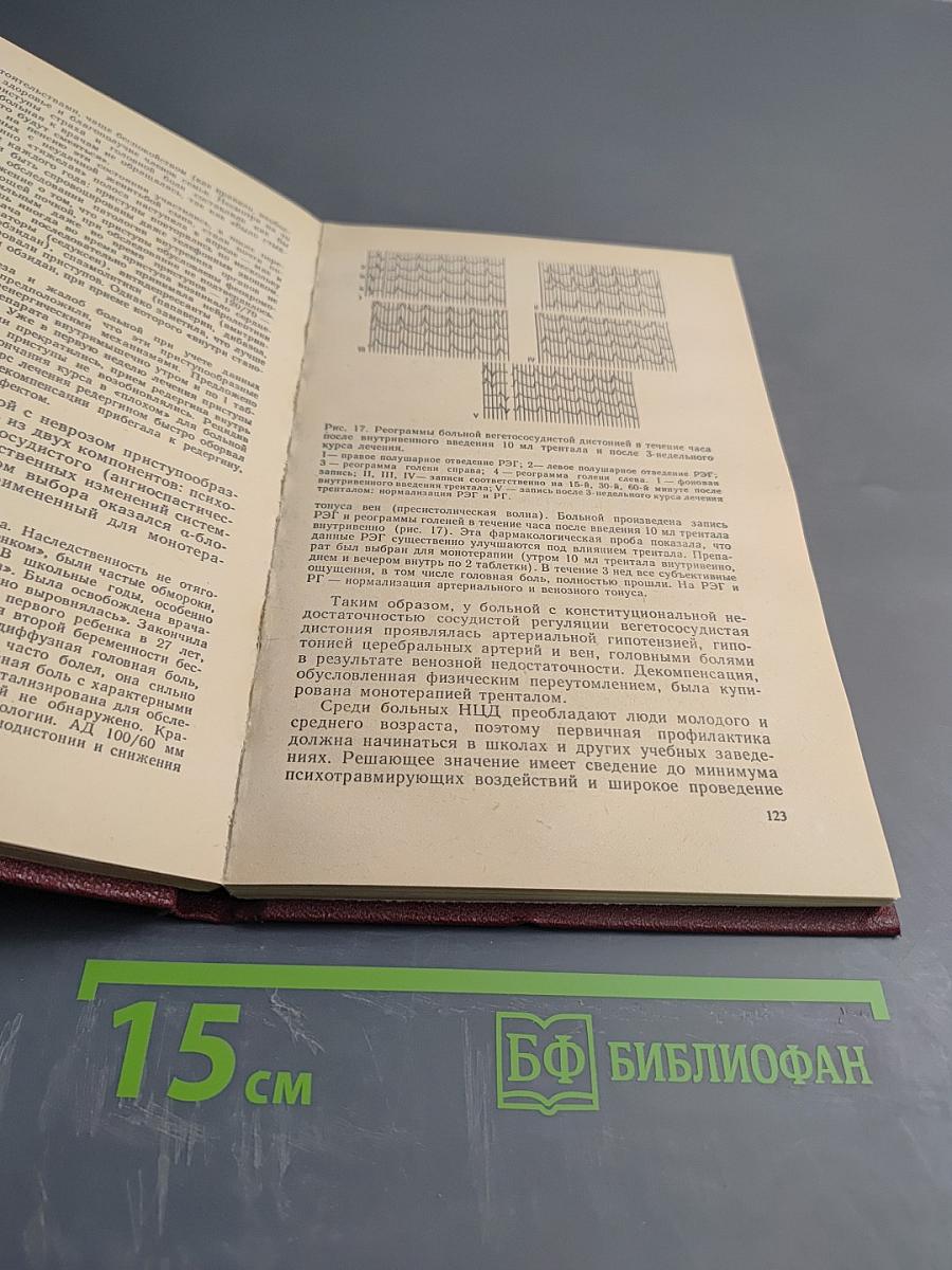 Головная боль