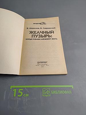 Желчный пузырь: когда камни мешают жить