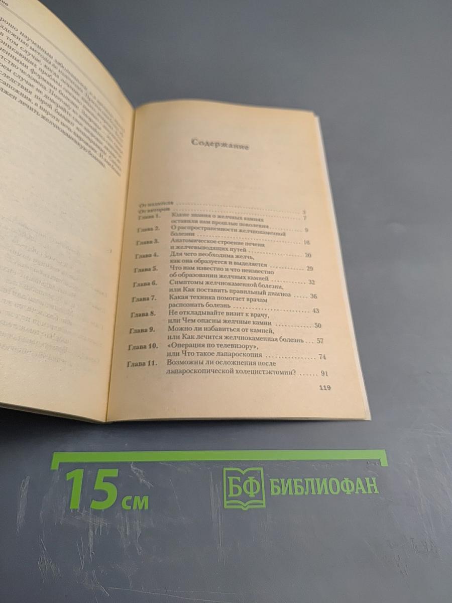 Желчный пузырь: когда камни мешают жить