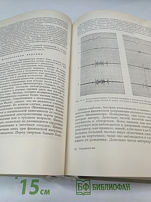 Частная кардиология, Часть I