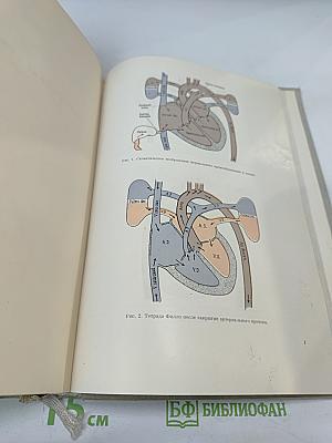 Частная кардиология, Часть I