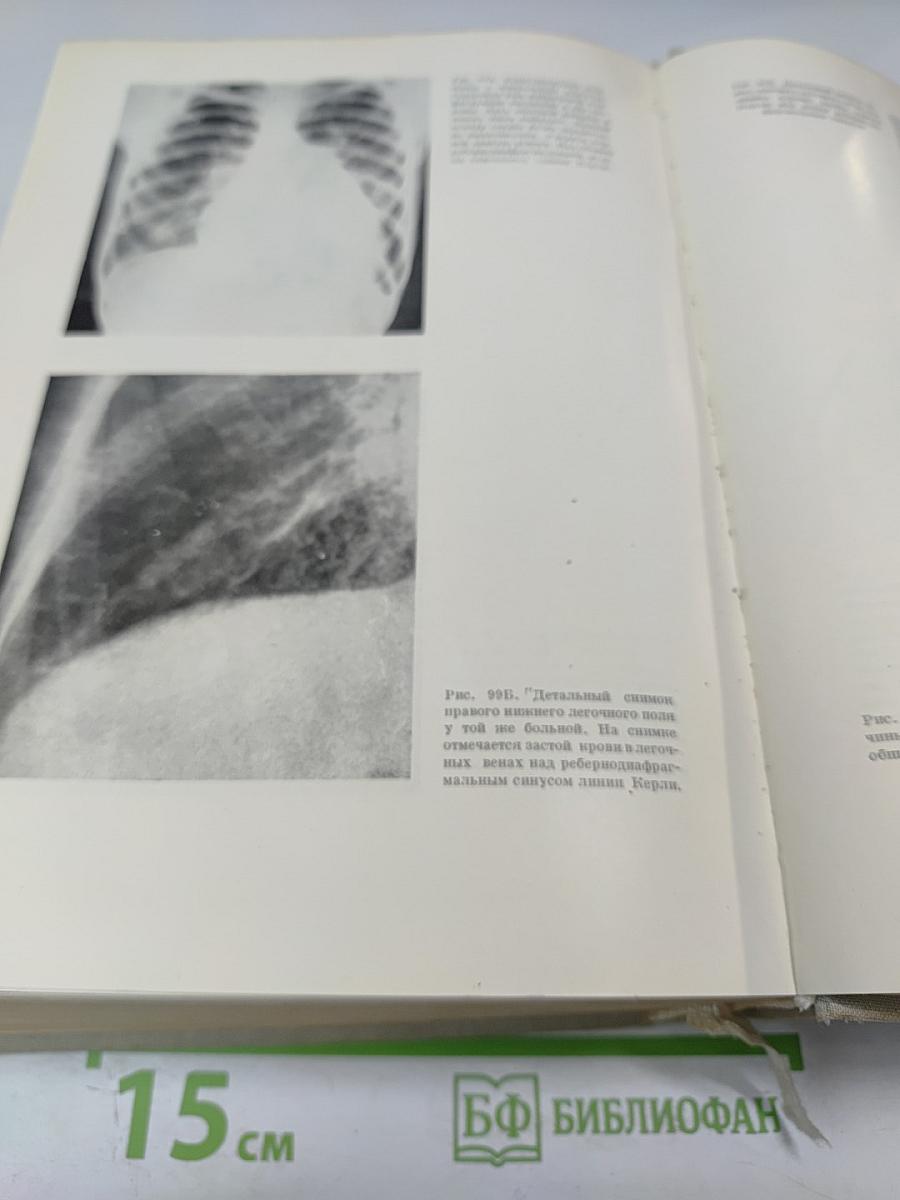 Частная кардиология, Часть I