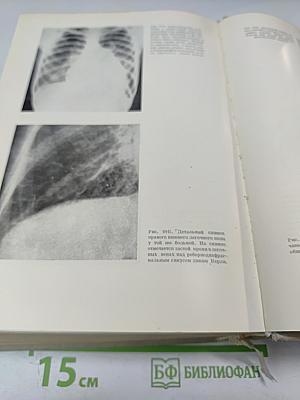 Частная кардиология, Часть I