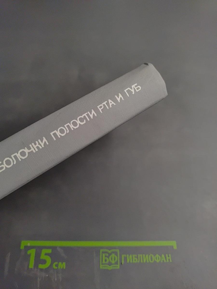 Заболевания слизистой оболочки полости рта и губ