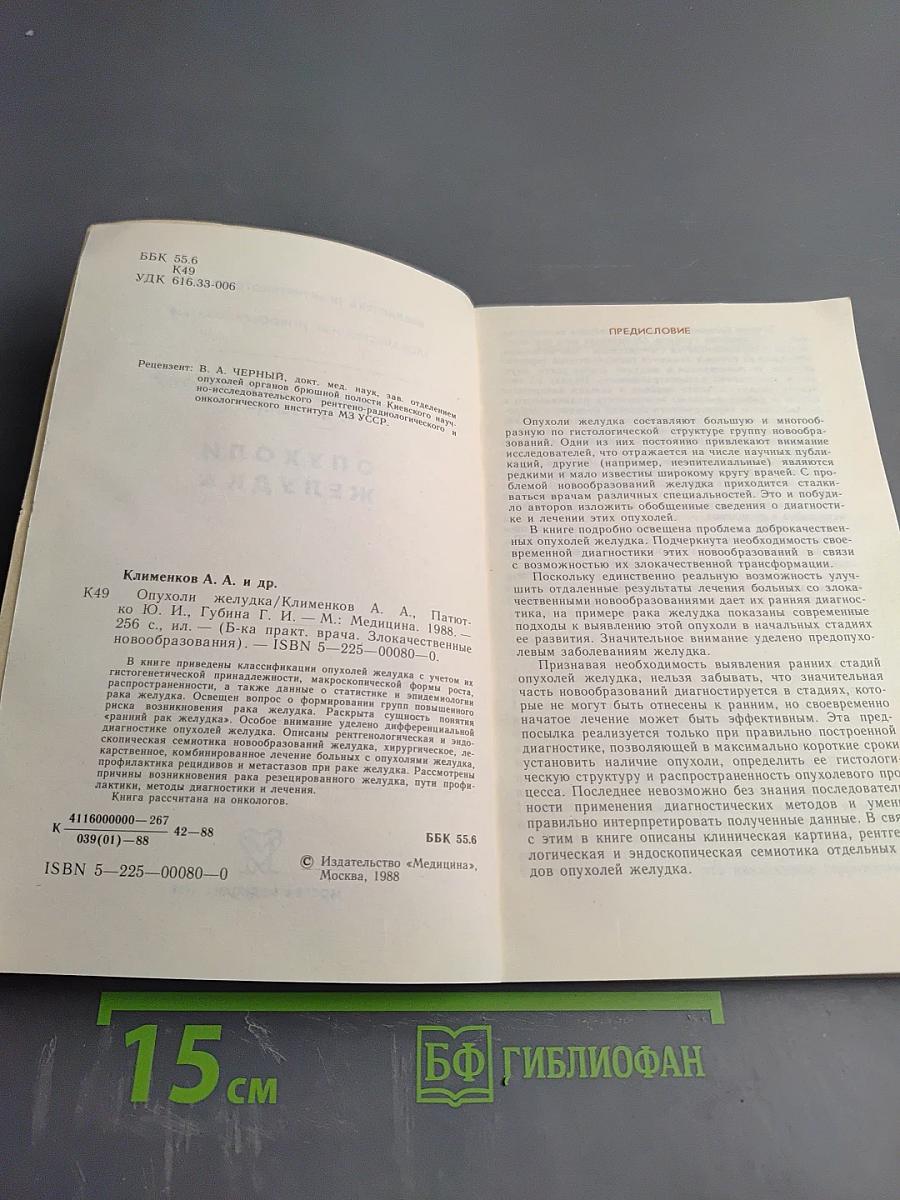 Опухоли желудка