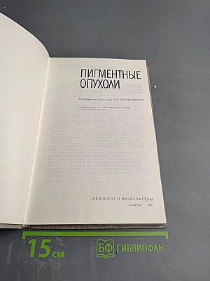 Пигментные опухоли