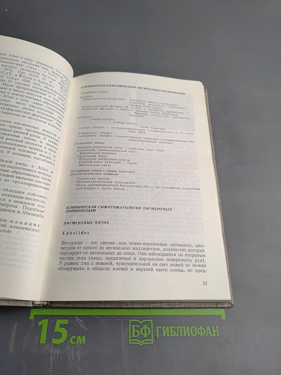 Пигментные опухоли