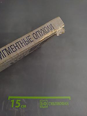 Пигментные опухоли