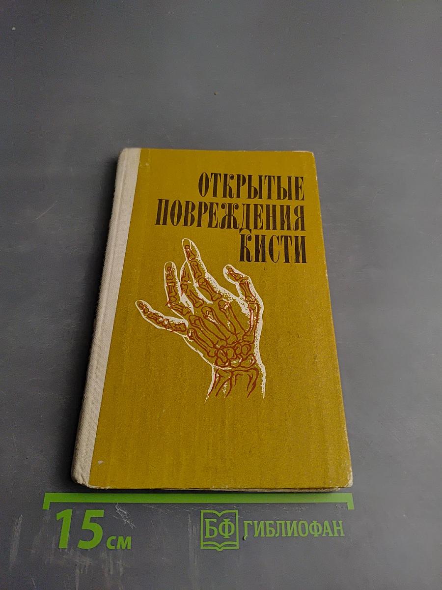Открытые повреждения кисти