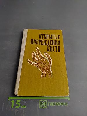 Открытые повреждения кисти