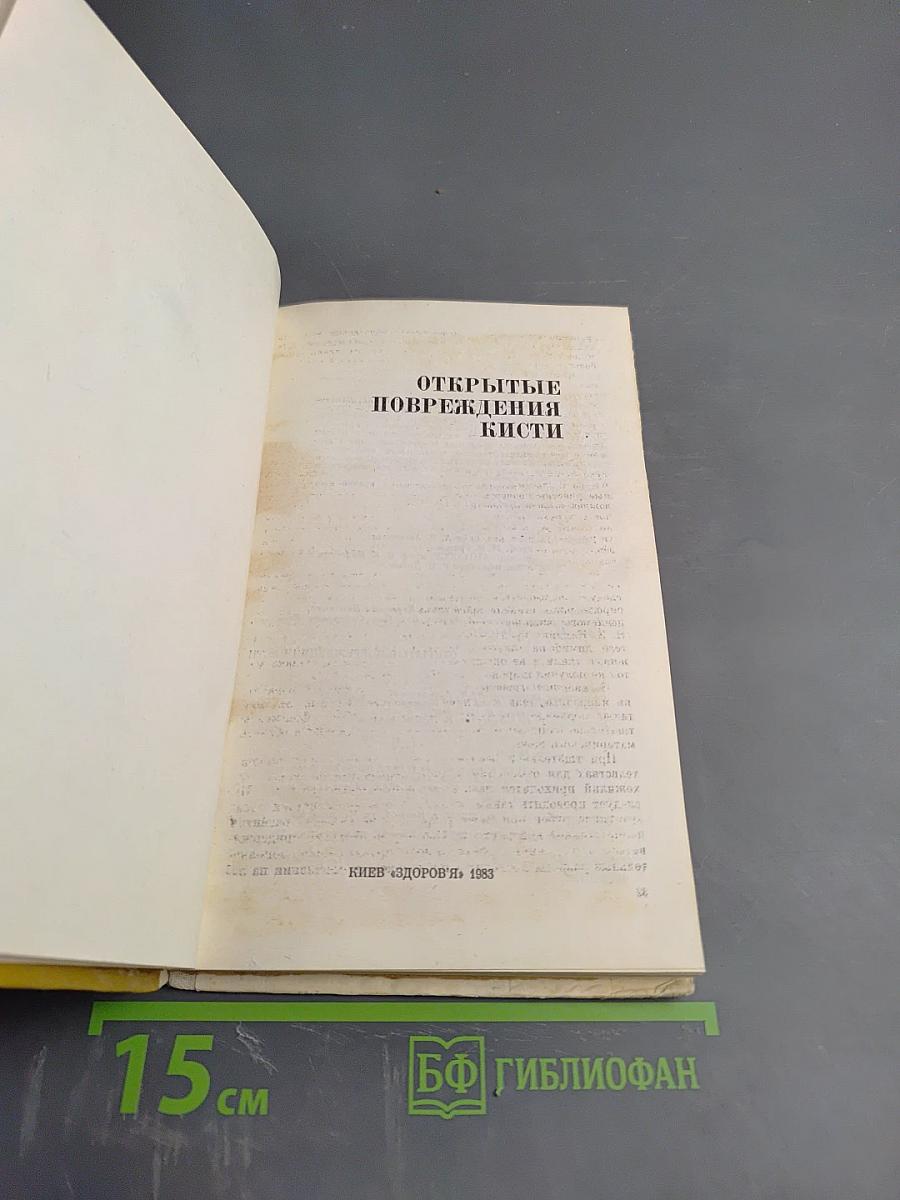 Открытые повреждения кисти