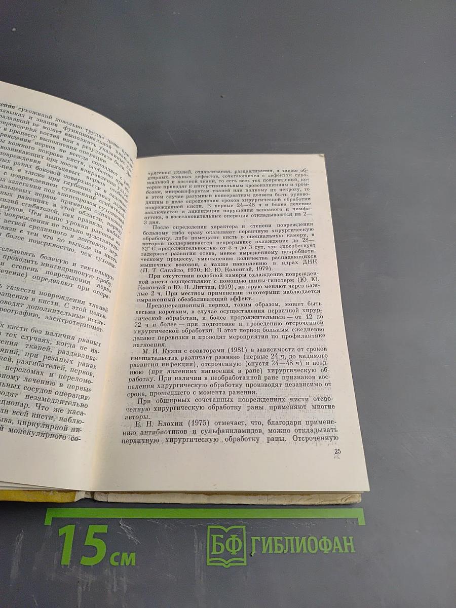 Открытые повреждения кисти