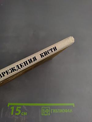 Открытые повреждения кисти