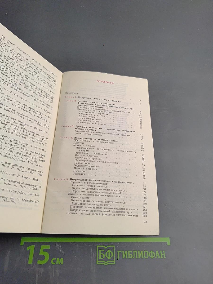 Хирургия кистевого сустава