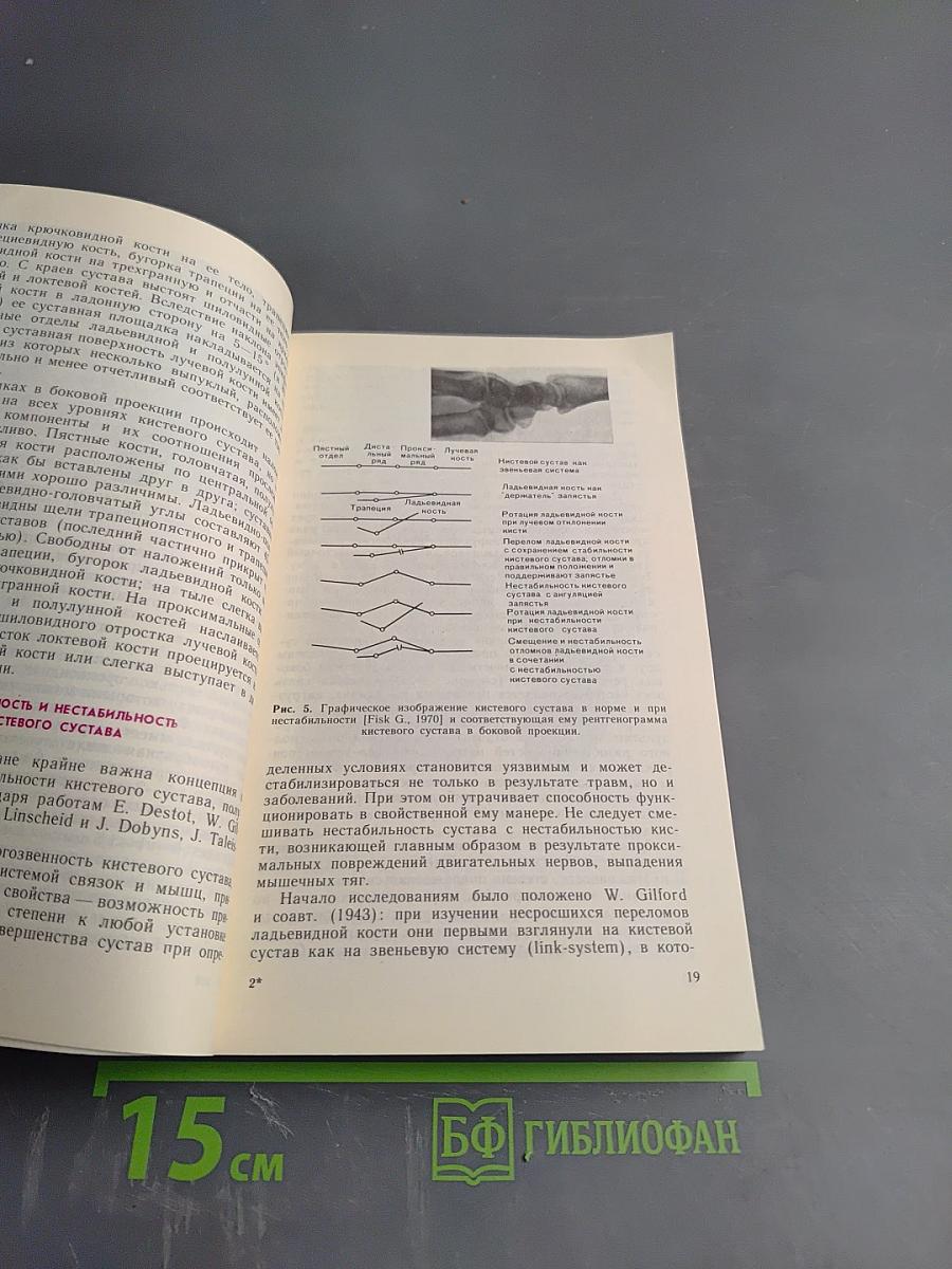 Хирургия кистевого сустава