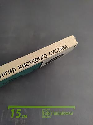 Хирургия кистевого сустава