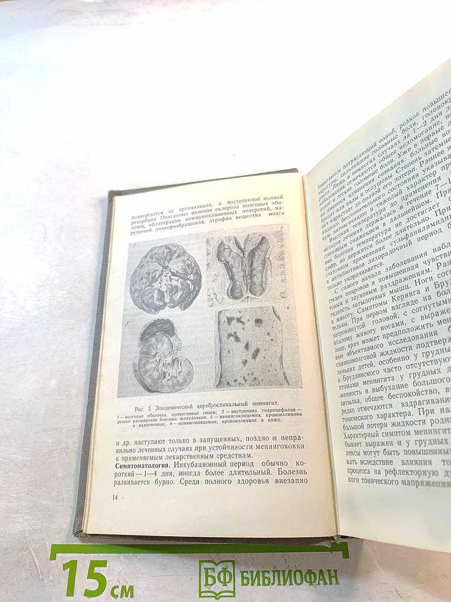Инфекционные заболевания нервной системы у детей