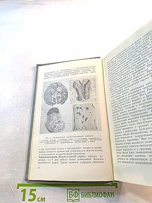 Инфекционные заболевания нервной системы у детей
