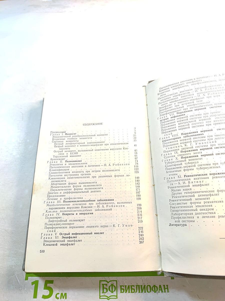 Инфекционные заболевания нервной системы у детей