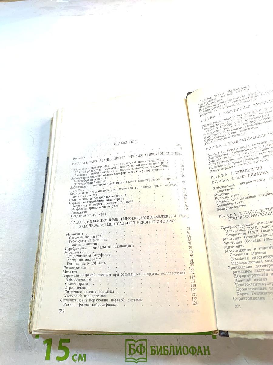 Лечение заболеваний нервной системы