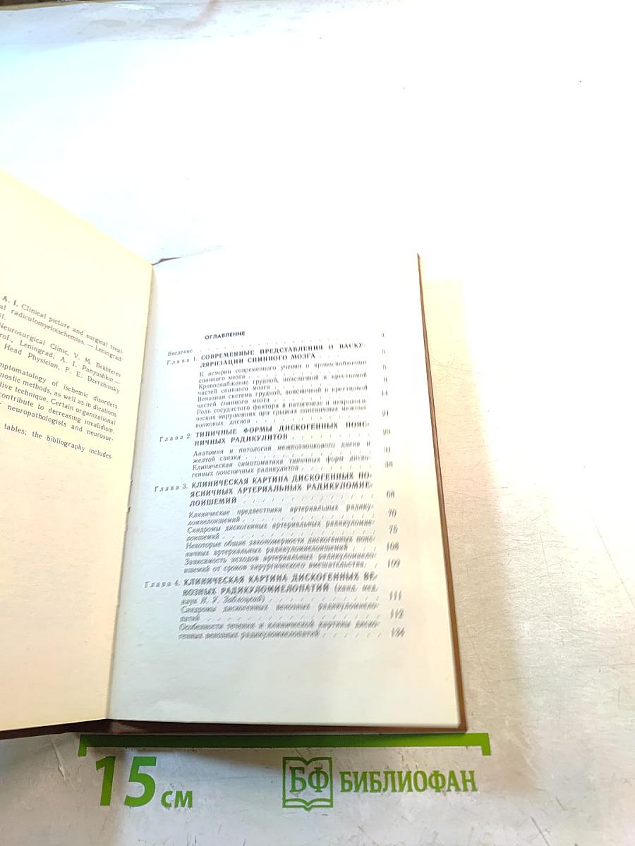 Клиника и хирургическое лечение дискогенных пояснично-крестцовых радикуломиело-ишемий