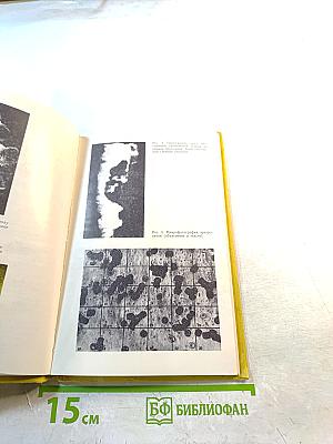 Микроциркуляция при дерматозах