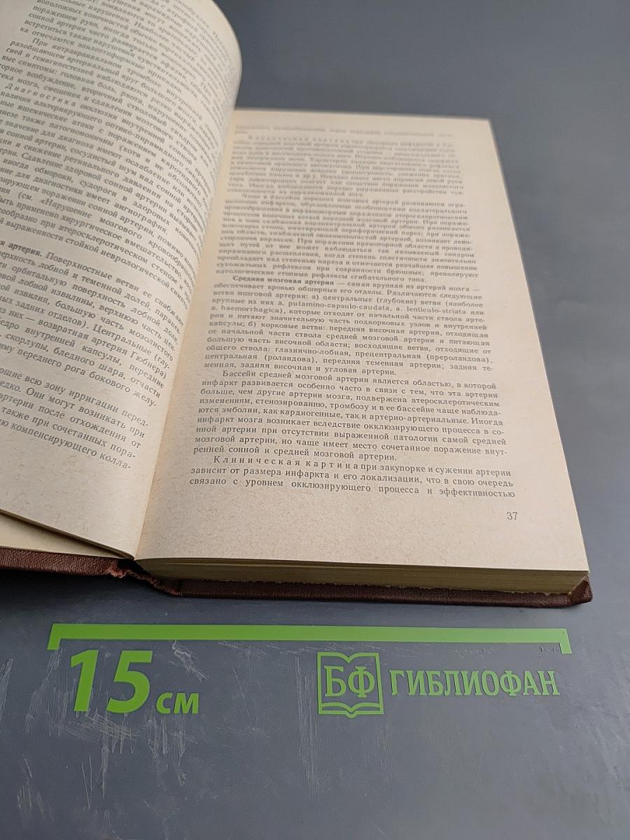 Справочник по неврологии