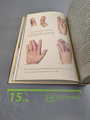 Хирургия заболеваний и повреждений кисти