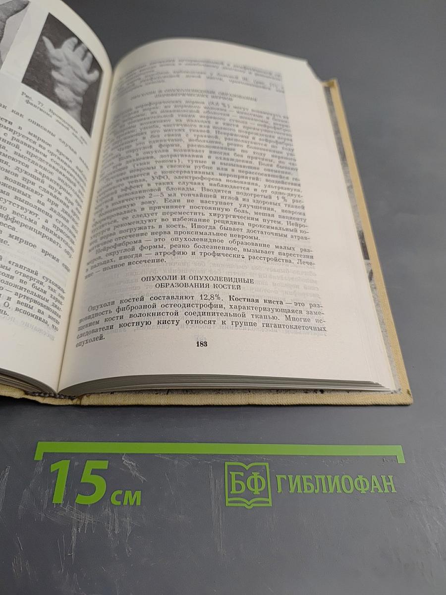 Хирургия заболеваний и повреждений кисти