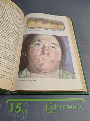 Кожные и венерические болезни