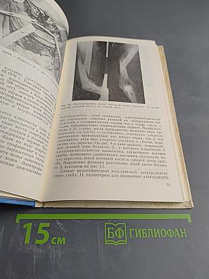 Дифференциальная диагностика и лечение повреждений нервов при различных травмах конечностей