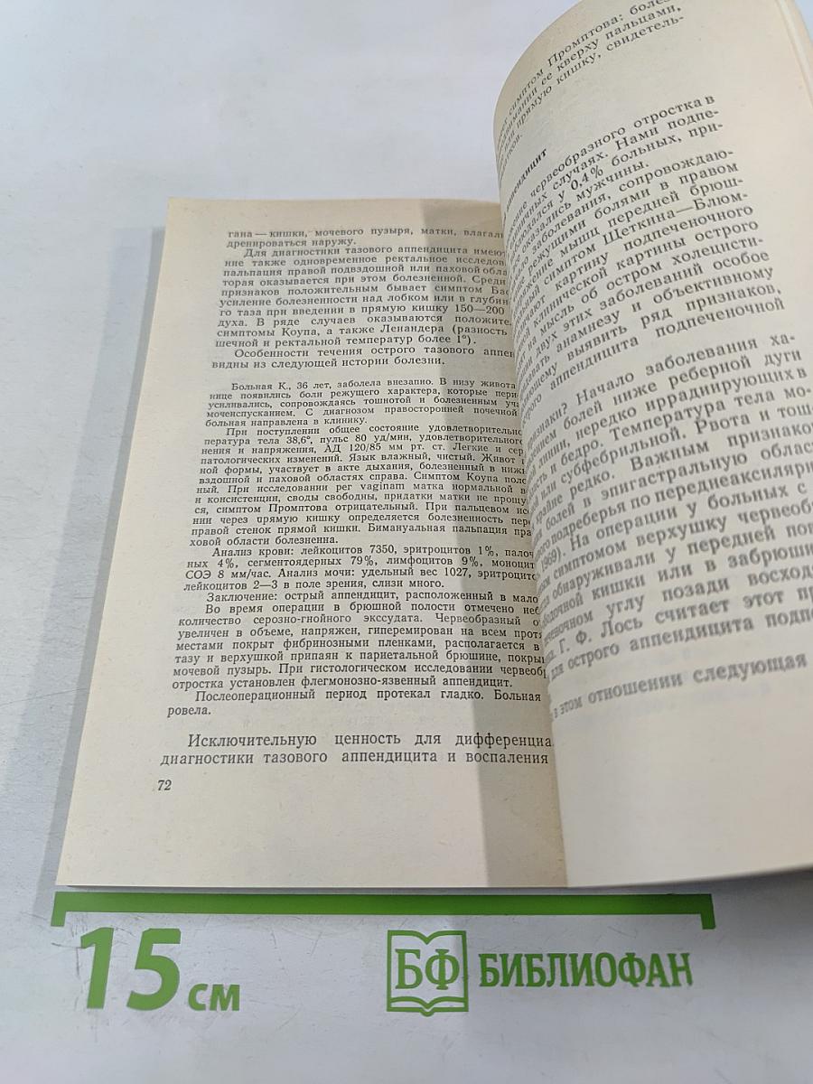 Диагностика острого аппендицита