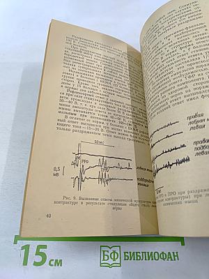 Контрактура мимической мускулатуры