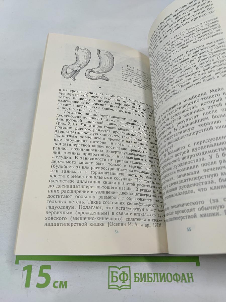 Спаечная болезнь