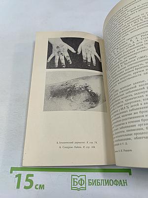 Аллергические заболевания